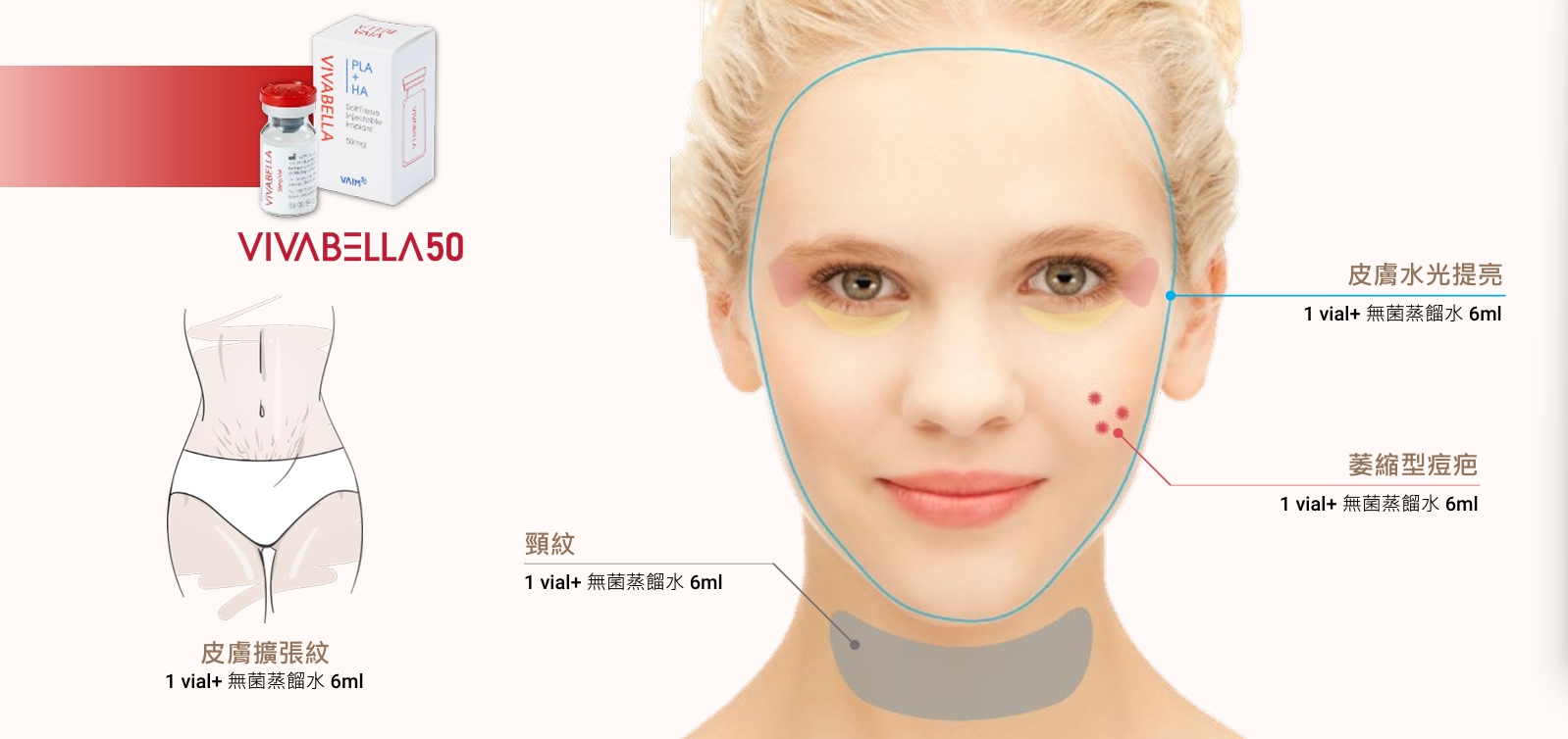 薇貝拉-適合對象