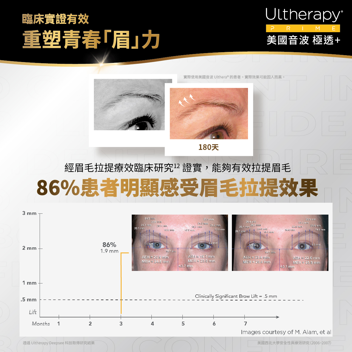 臨床實證-眉毛拉提