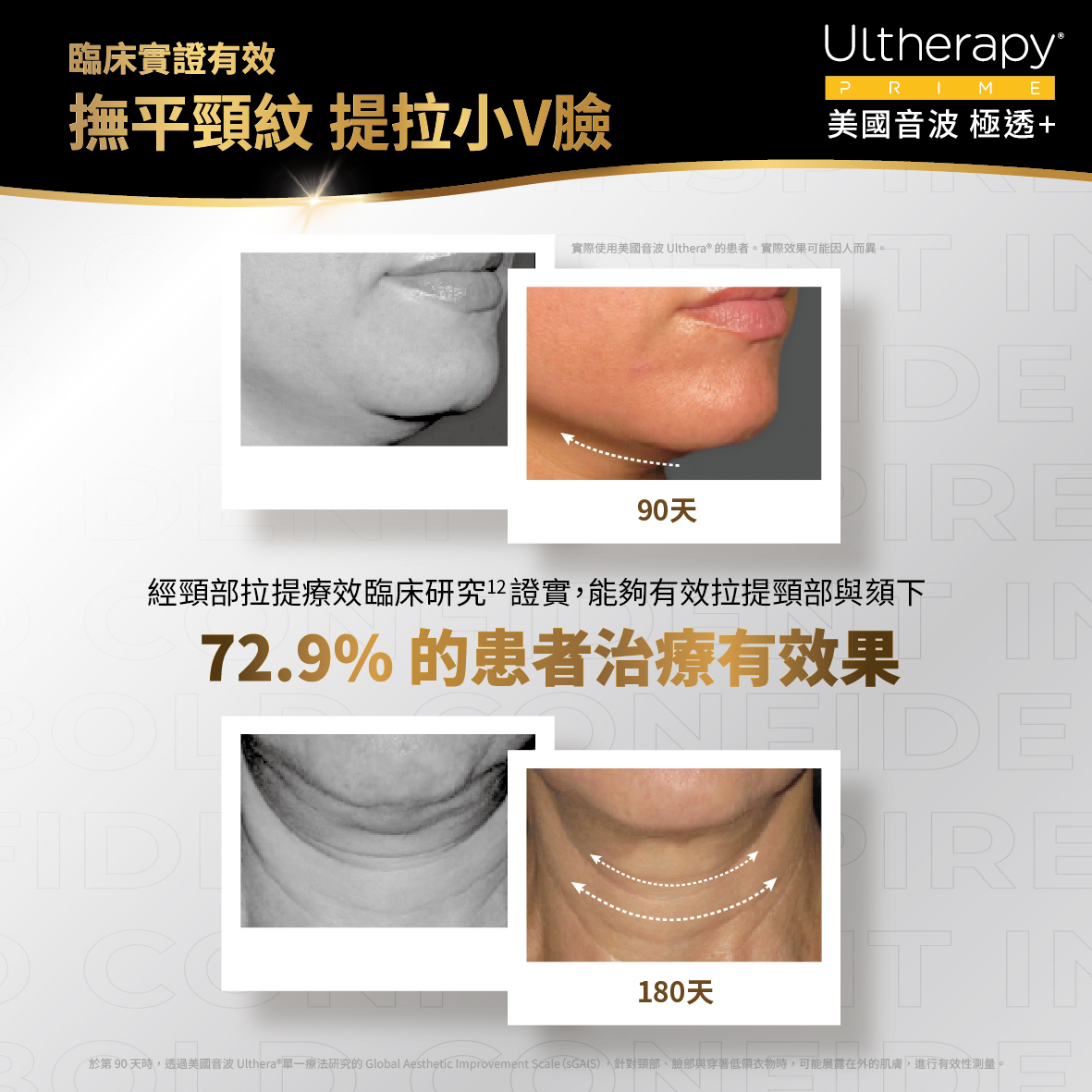 臨床實證-臉部、頸部拉提