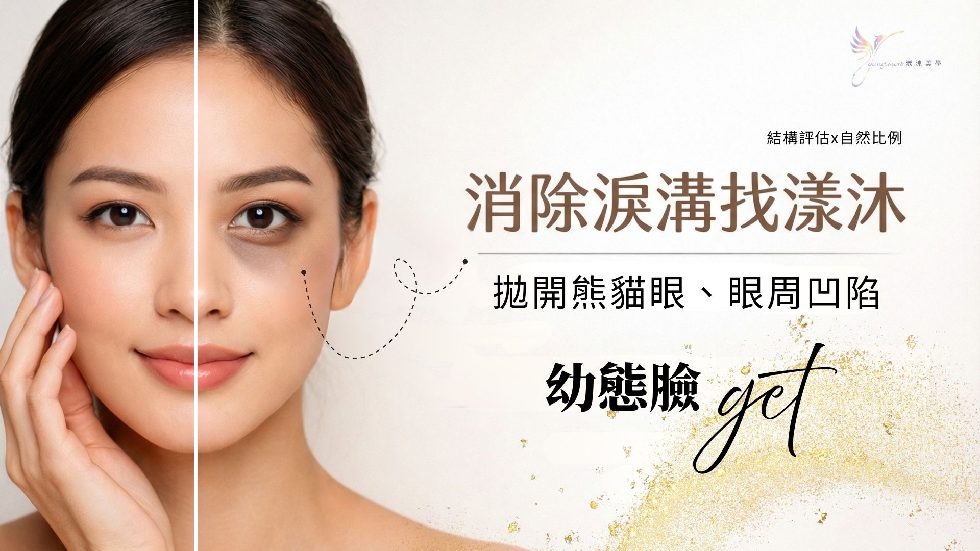 淚溝別再靠遮瑕!深入解析眼下凹陷成因,用專業醫美療程告別倦容